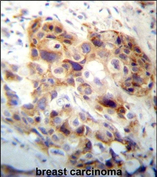 PI15 Antibody in Immunohistochemistry (IHC)