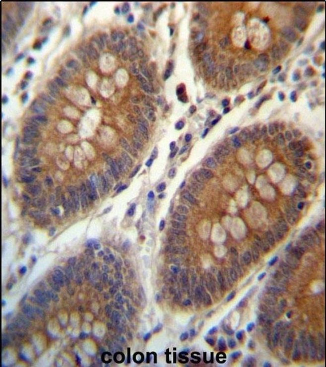 TRIM38 Antibody in Immunohistochemistry (IHC)