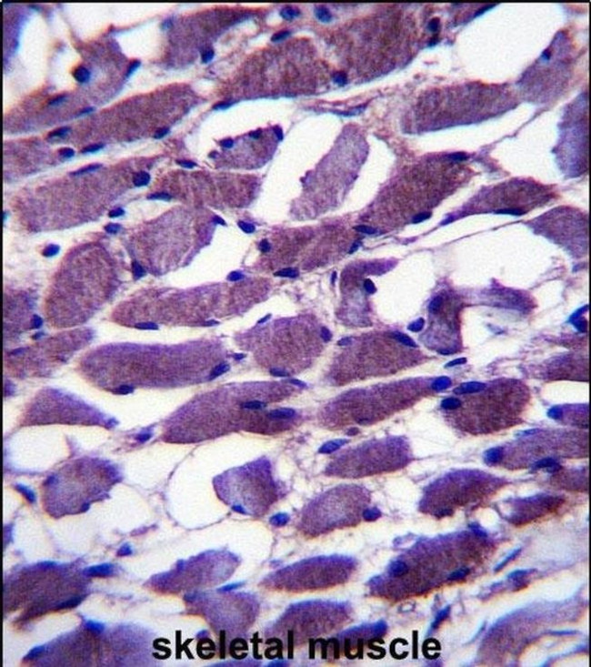 MYOM1 Antibody in Immunohistochemistry (IHC)