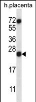 RNASE8 Antibody in Western Blot (WB)
