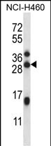 METTL23 Antibody in Western Blot (WB)