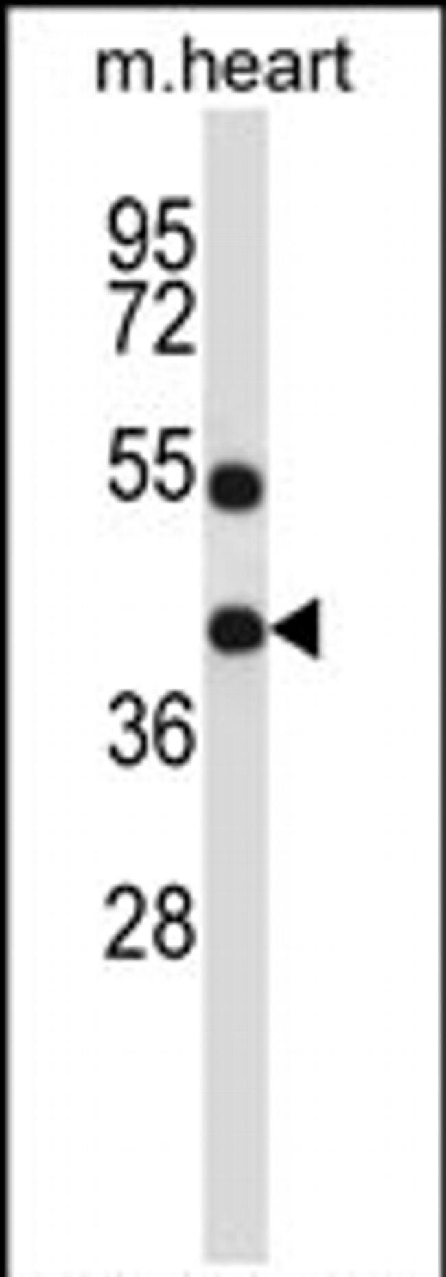 DTX3 Antibody in Western Blot (WB)