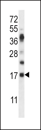 RNASE6 Antibody in Western Blot (WB)
