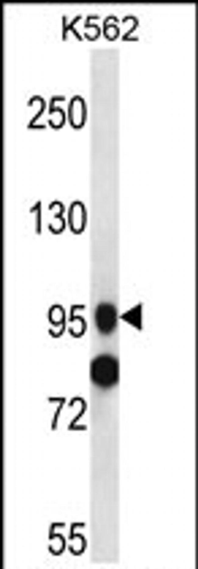 SIDT1 Antibody in Western Blot (WB)