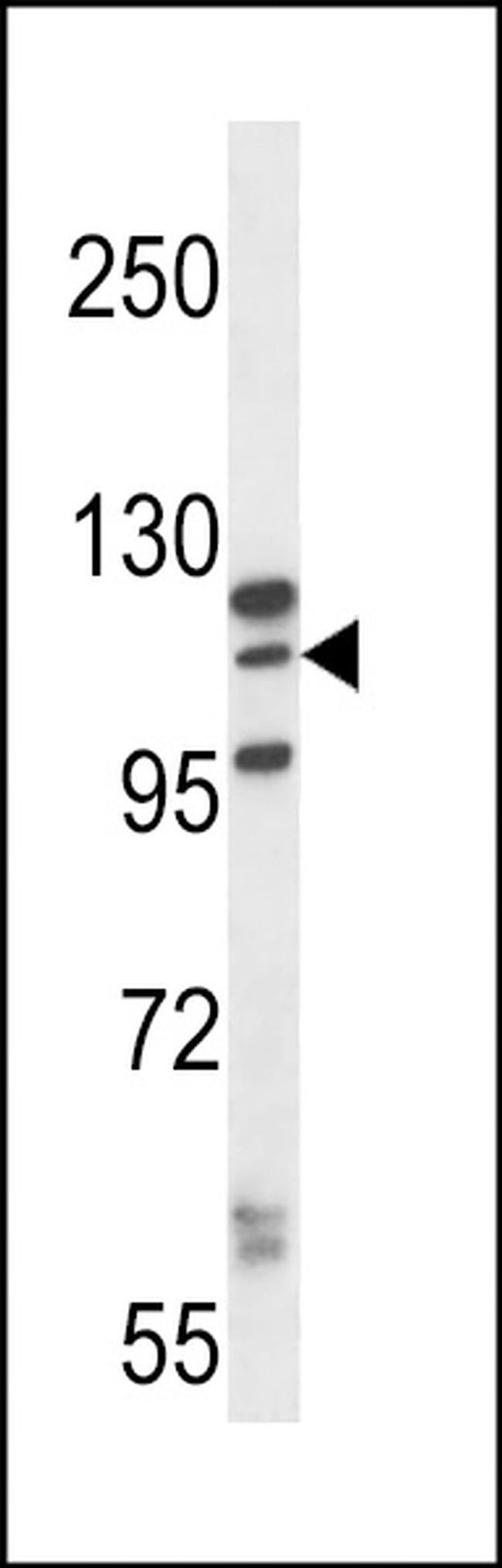 MORC1 Antibody in Western Blot (WB)