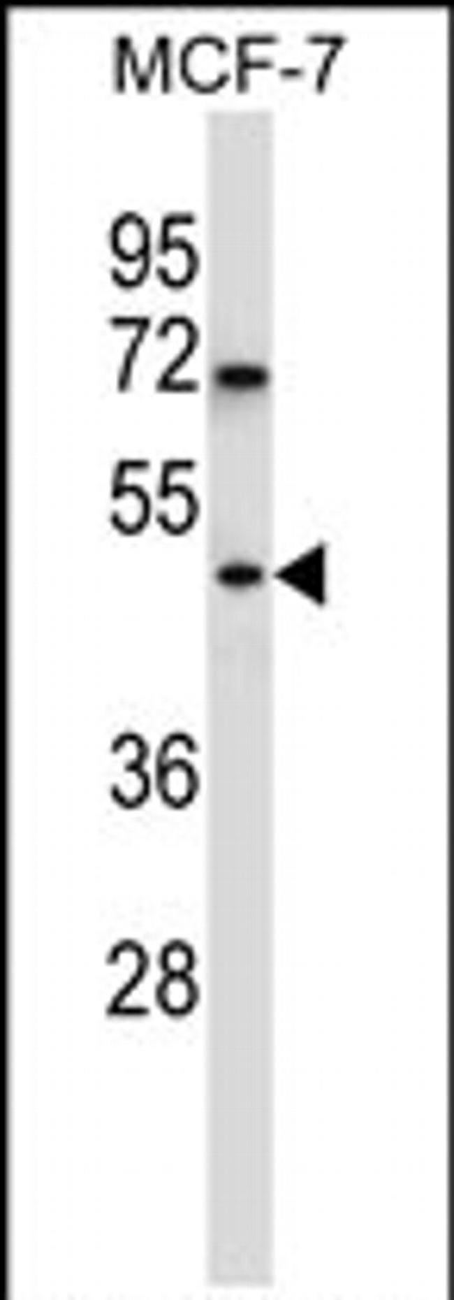 WDR88 Antibody in Western Blot (WB)