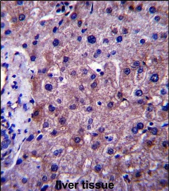 SGMS1 Antibody in Immunohistochemistry (IHC)