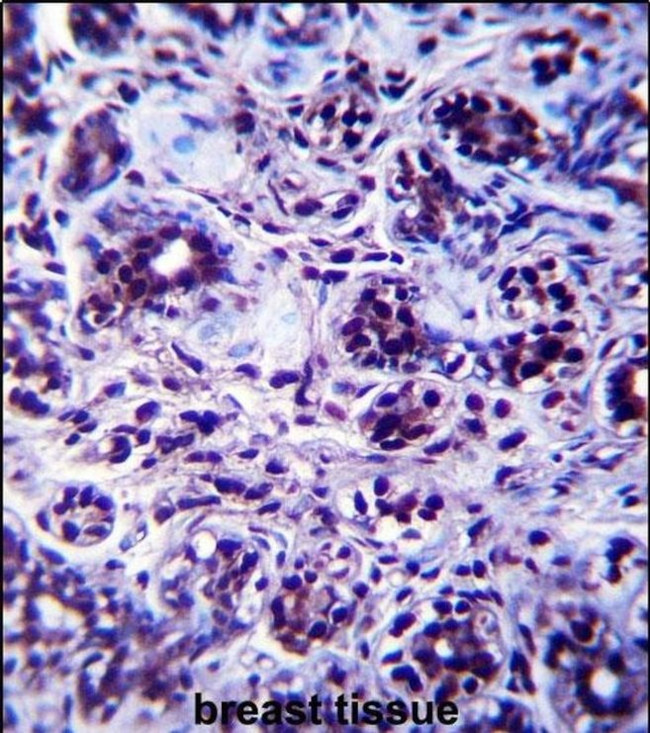 DHX32 Antibody in Immunohistochemistry (IHC)