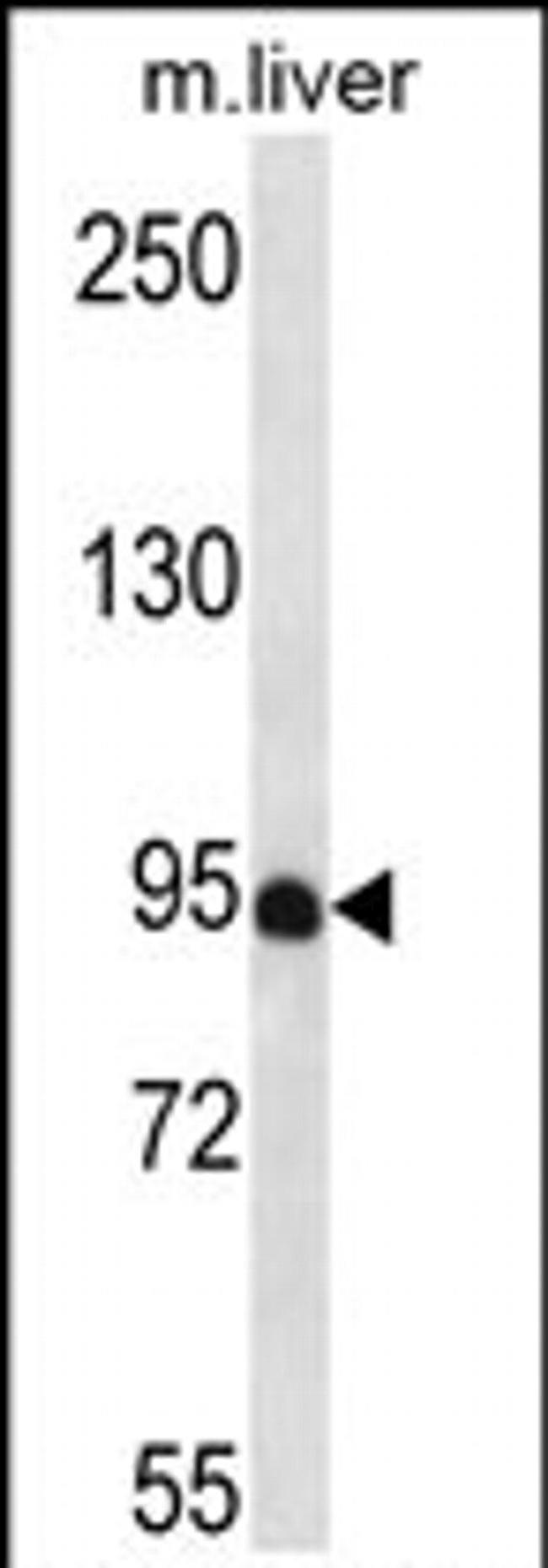 PDZD4 Antibody in Western Blot (WB)