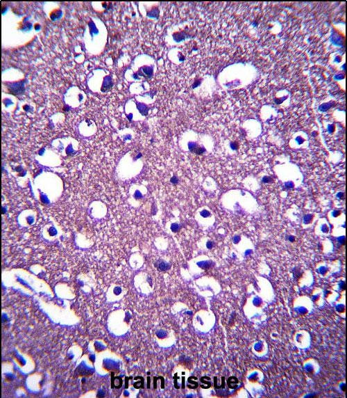 PCDHGA3 Antibody in Immunohistochemistry (Paraffin) (IHC (P))