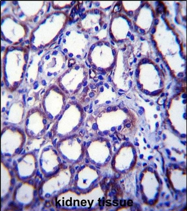 TRIM34 Antibody in Immunohistochemistry (IHC)
