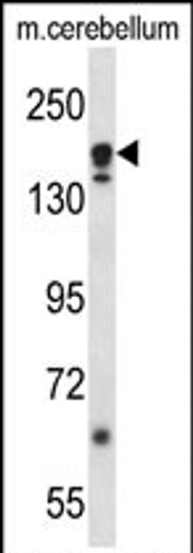 ATG2A Antibody in Western Blot (WB)