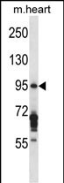 EXOC6B Antibody in Western Blot (WB)