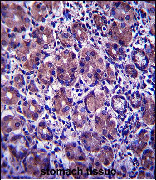 ANKRD22 Antibody in Immunohistochemistry (Paraffin) (IHC (P))