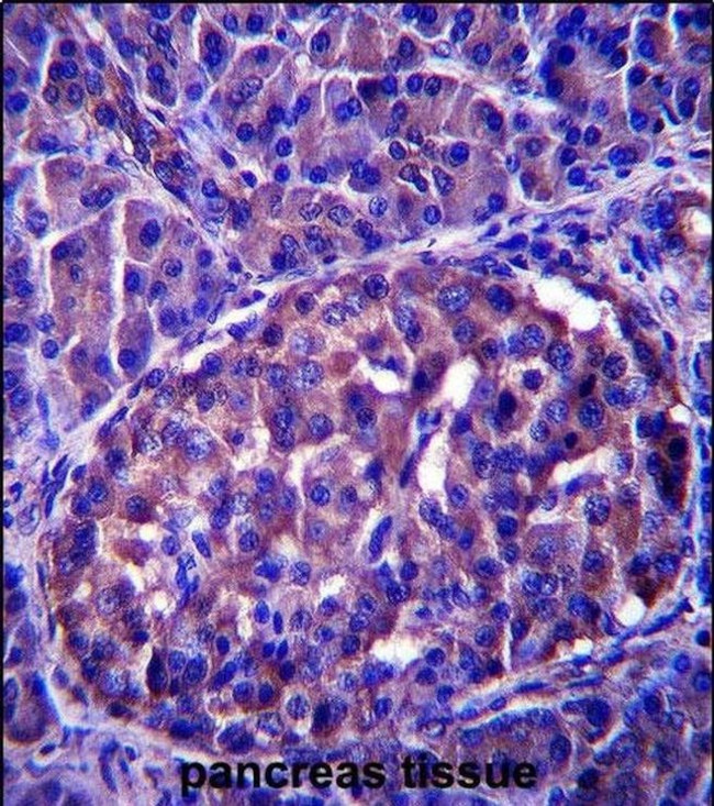 LRRN4 Antibody in Immunohistochemistry (IHC)