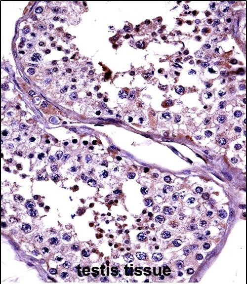 CTAG2 Antibody in Immunohistochemistry (Paraffin) (IHC (P))