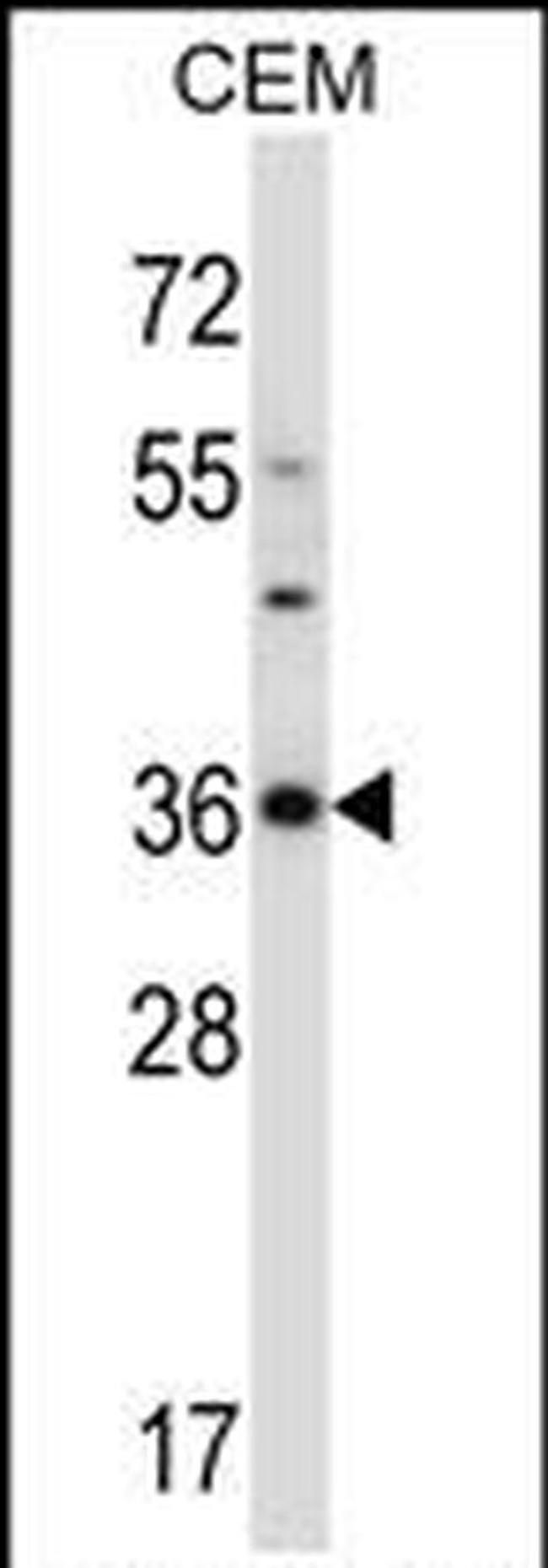 CDK3 Antibody in Western Blot (WB)