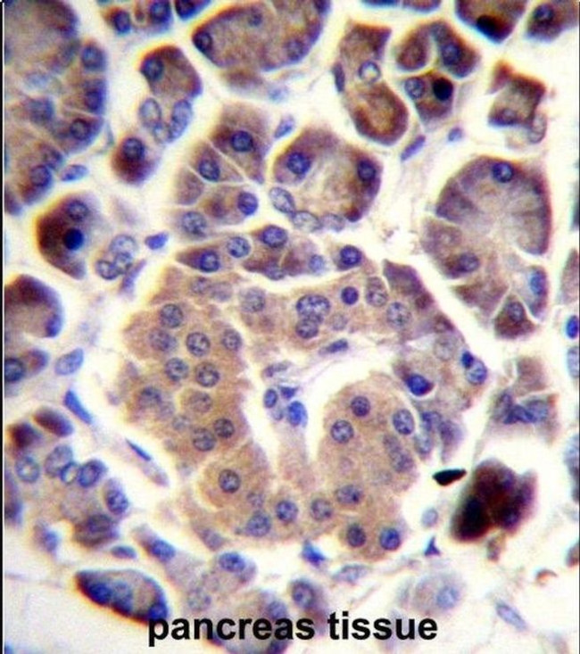 TRIM36 Antibody in Immunohistochemistry (IHC)