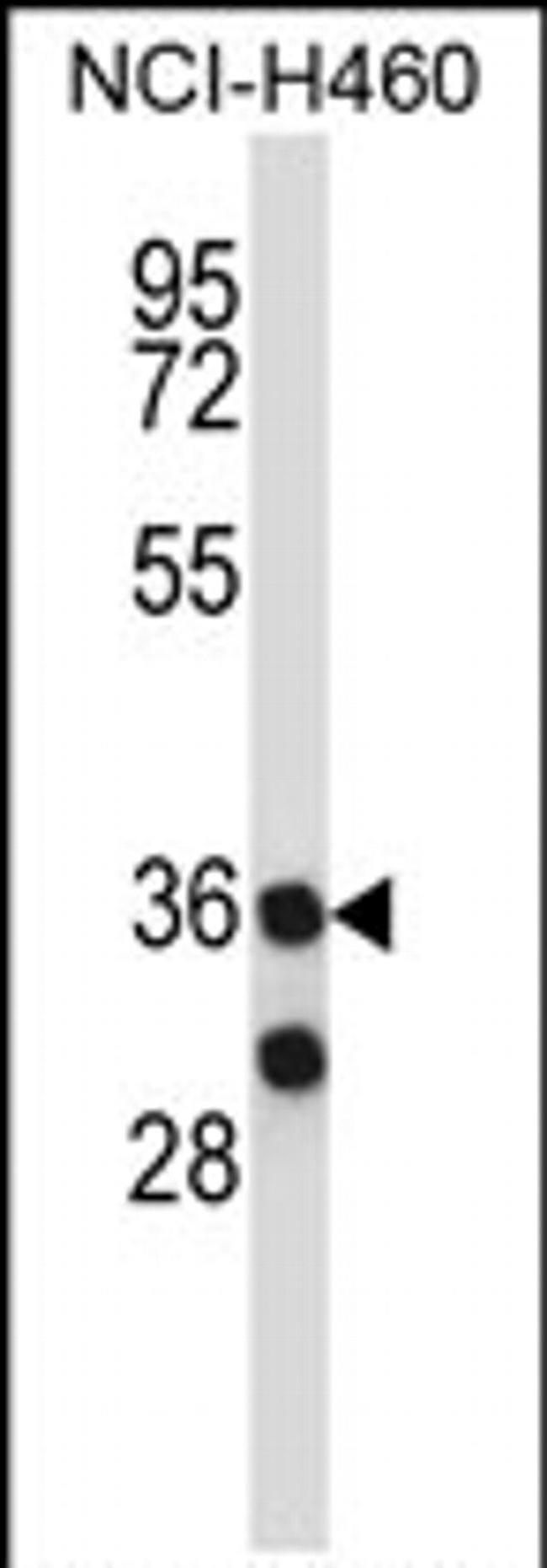 MARCH11 Antibody in Western Blot (WB)