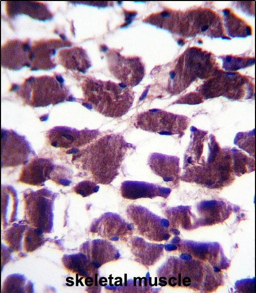 LRIG2 Antibody in Immunohistochemistry (Paraffin) (IHC (P))