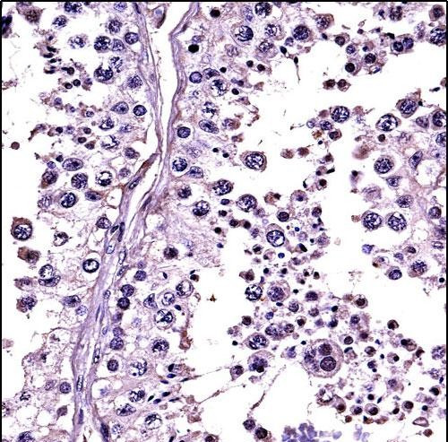 Relaxin 1/2 Antibody in Immunohistochemistry (Paraffin) (IHC (P))
