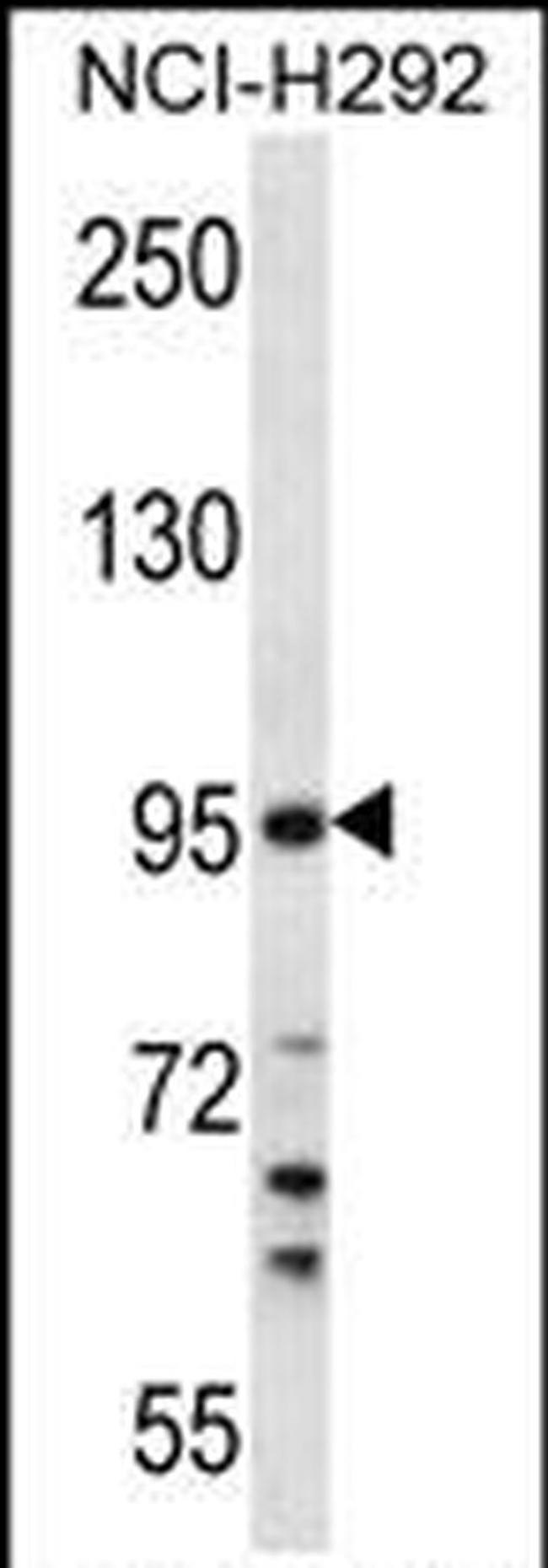 TMPRSS7 Antibody in Western Blot (WB)