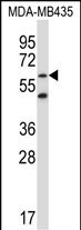 ZNF479 Antibody in Western Blot (WB)