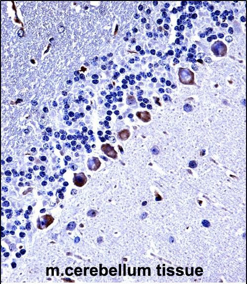 CK1 gamma Antibody in Immunohistochemistry (Paraffin) (IHC (P))