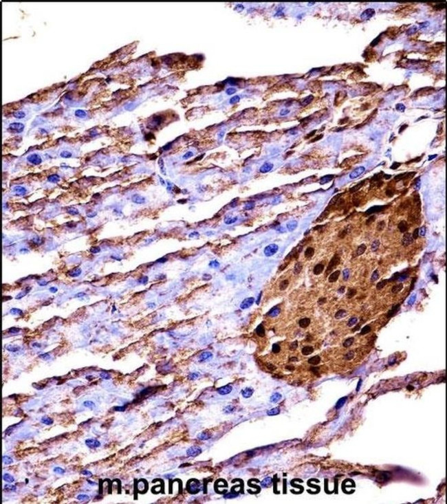 MEKK2 Antibody in Immunohistochemistry (IHC)