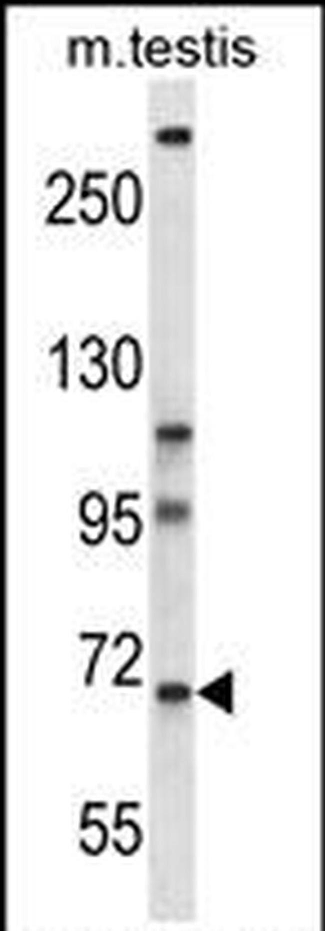 PAN3 Antibody in Western Blot (WB)