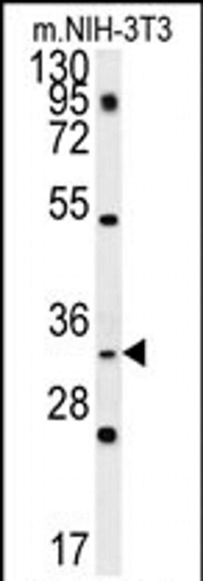 Enkurin Antibody in Western Blot (WB)