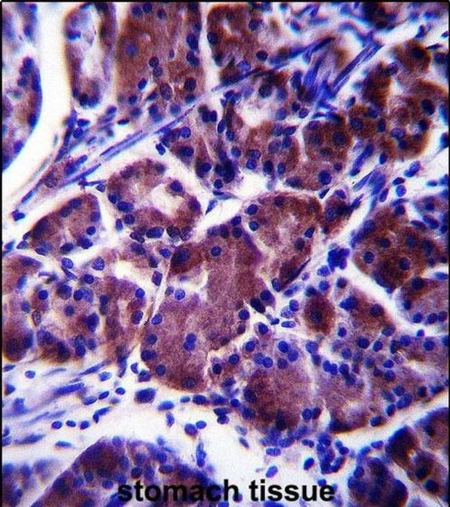 LYPLAL1 Antibody in Immunohistochemistry (IHC)