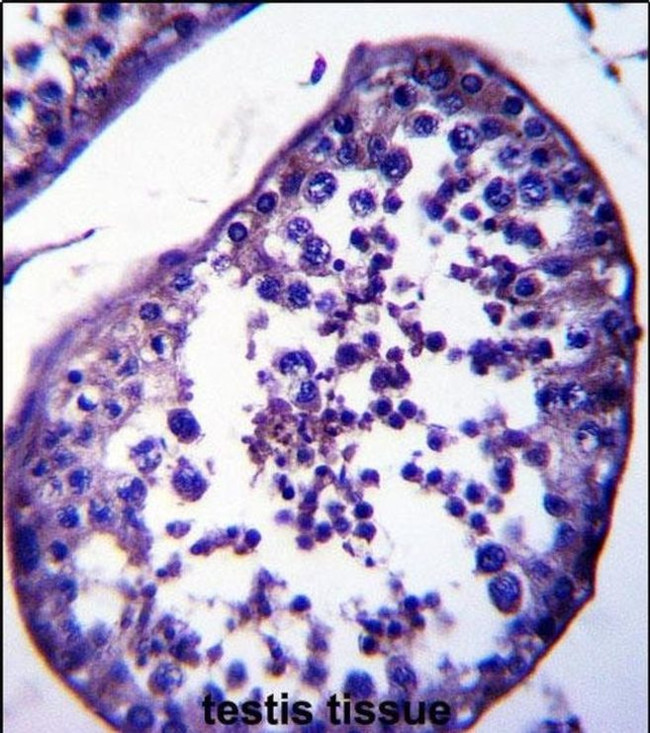 SPATA18 Antibody in Immunohistochemistry (IHC)