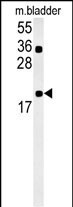 CCDC12 Antibody in Western Blot (WB)