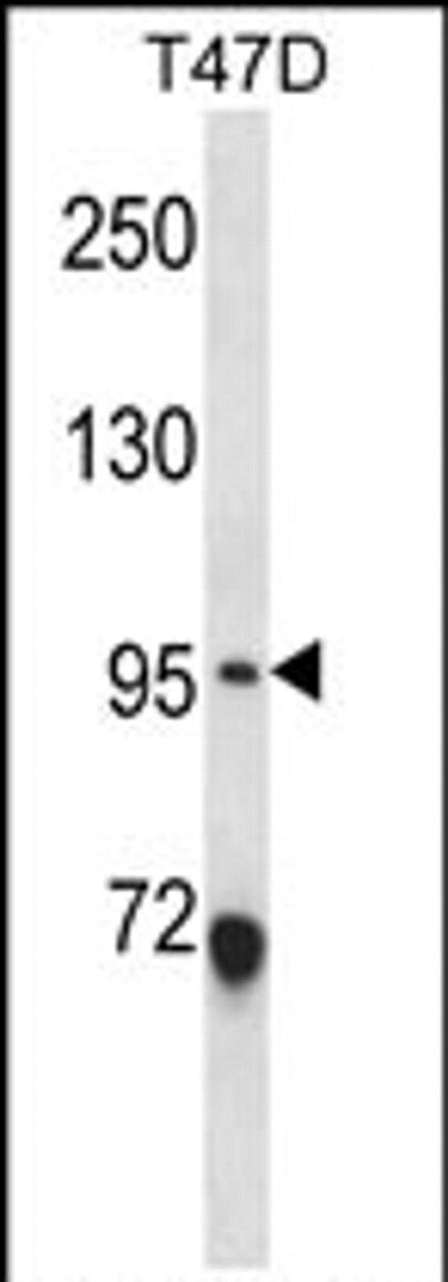 ANKS6 Antibody in Western Blot (WB)
