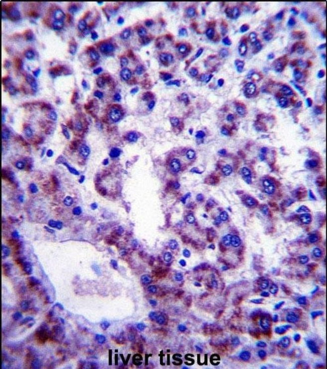 PLSCR4 Antibody in Immunohistochemistry (IHC)
