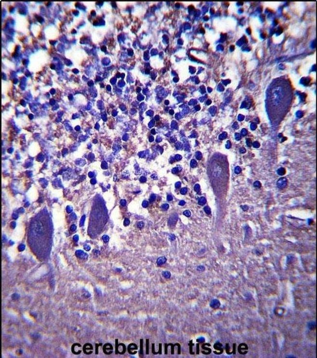 LRRC8B Antibody in Immunohistochemistry (IHC)