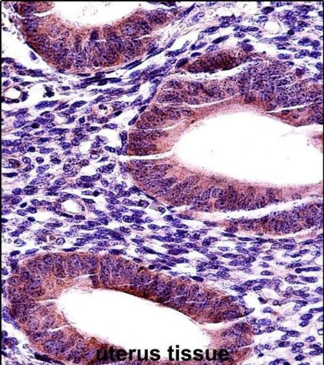 MMP17 Antibody in Immunohistochemistry (IHC)