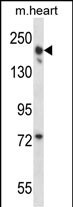 LRRC16B Antibody in Western Blot (WB)