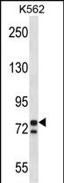 PCSK7 Antibody in Western Blot (WB)
