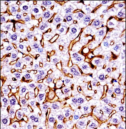 RON Antibody in Immunohistochemistry (Paraffin) (IHC (P))