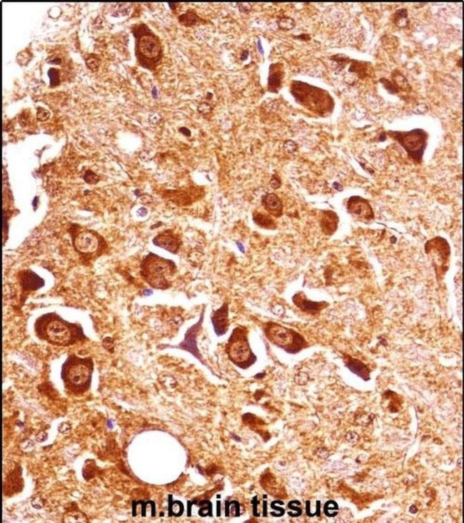PXK Antibody in Immunohistochemistry (IHC)