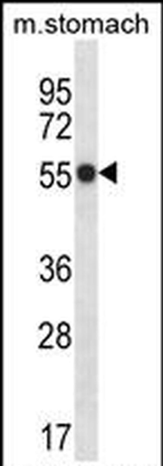 PHKG1 Antibody in Western Blot (WB)