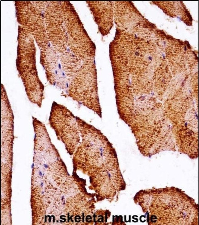 MLK2 Antibody in Immunohistochemistry (IHC)