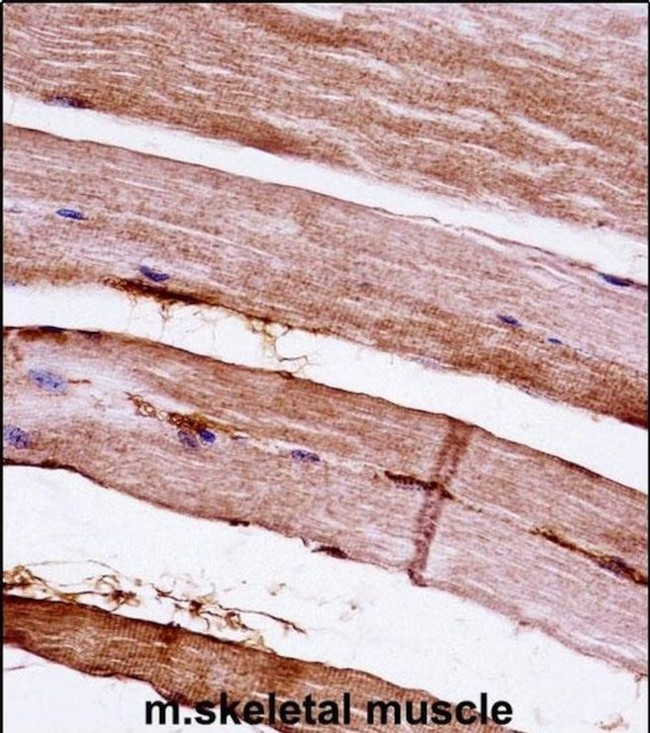 MAPKAPK3 Antibody in Immunohistochemistry (IHC)