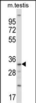 SGK494 Antibody in Western Blot (WB)