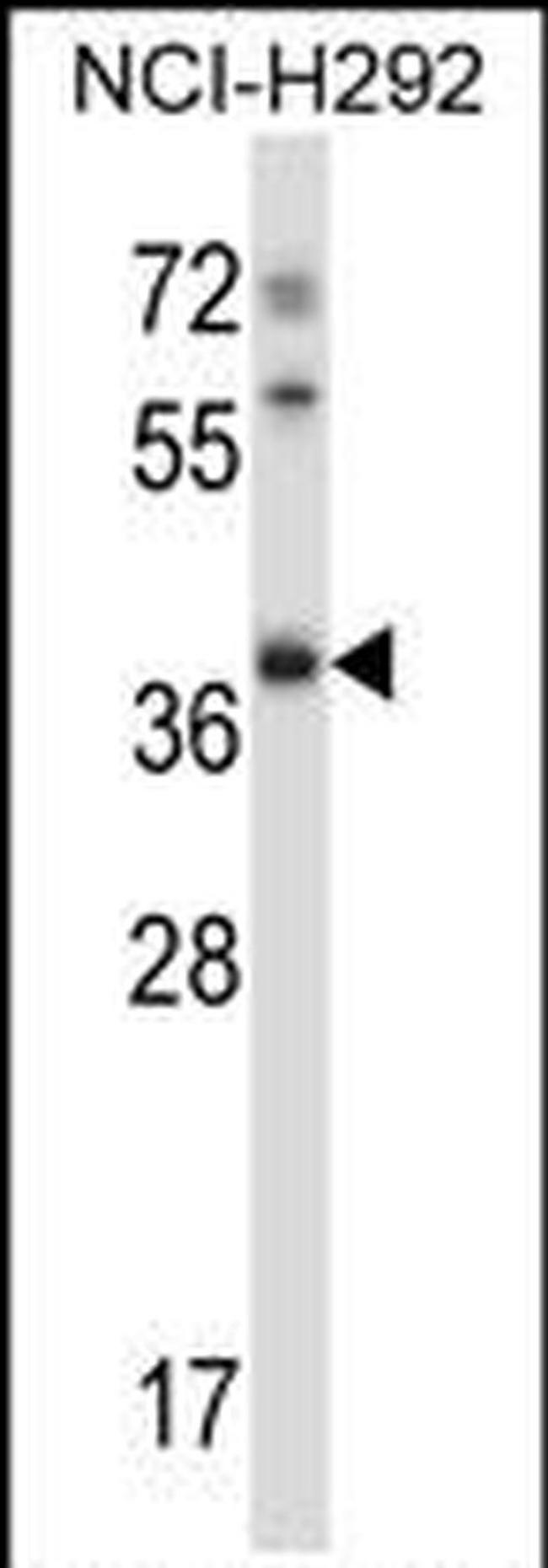 TSSK6 Antibody in Western Blot (WB)