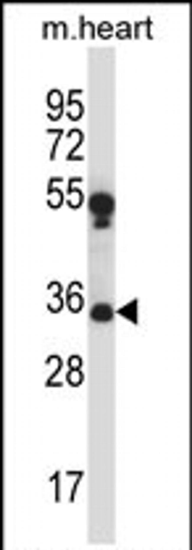 MARCH1 Antibody in Western Blot (WB)