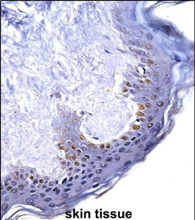 HOXC4 Antibody in Immunohistochemistry (IHC)