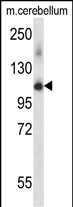 PRPF4B Antibody in Western Blot (WB)